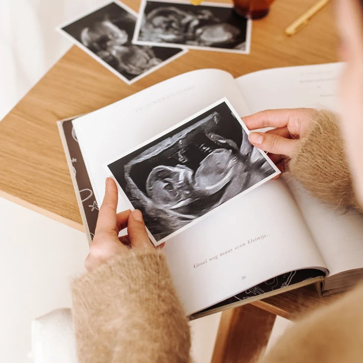 Het begin van jouw leven – All-in-one Schwangerschafts- und Baby-Erinnerungsbuch von 0 bis 1 Jahr – Birth Lines